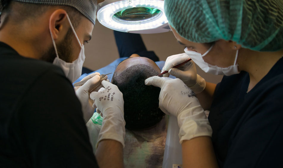 Doctors Performing Hair transplantation Procedure