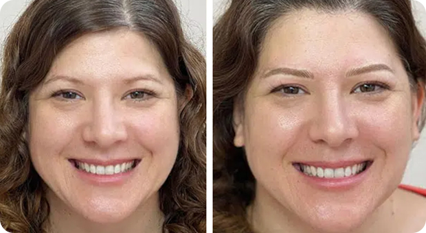 Paula scarpino before and after Henna Brows, showcasing fuller, more defined eyebrows